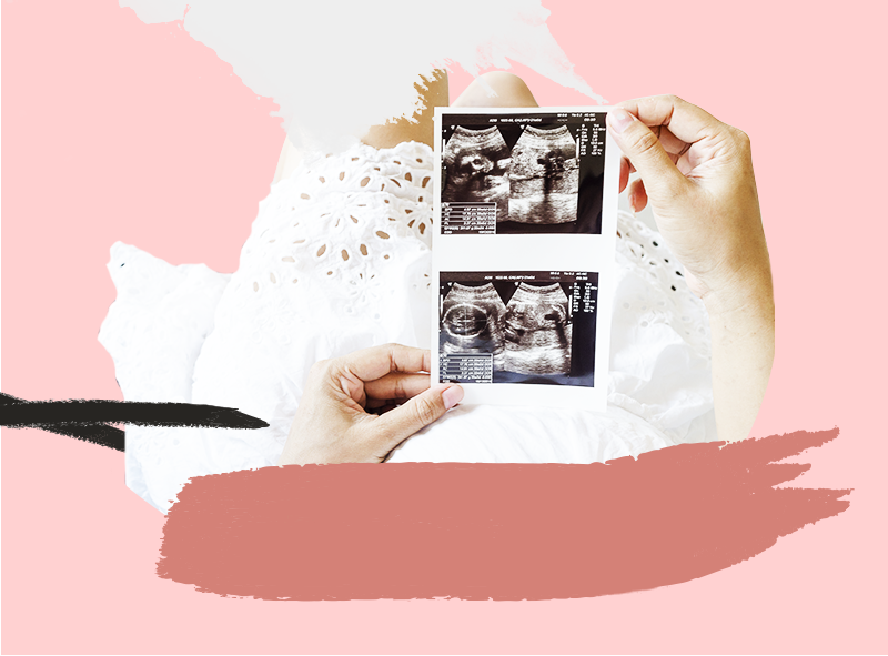 Aborto en México