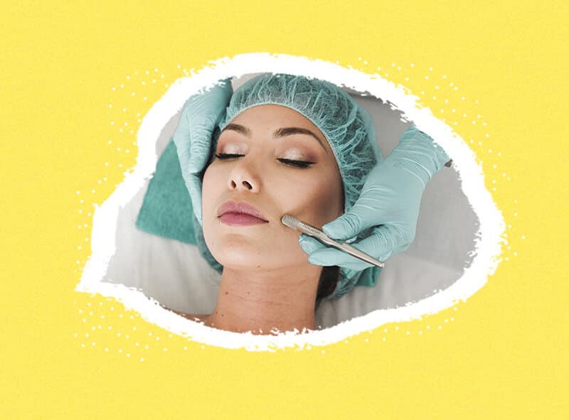 tratamientos de belleza más extraños