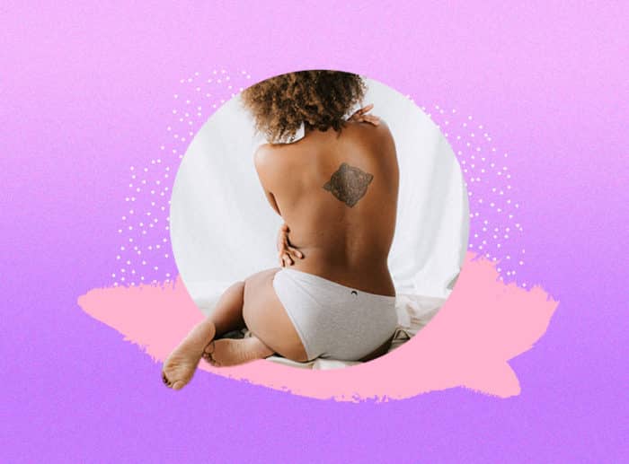 vivir con herpes
